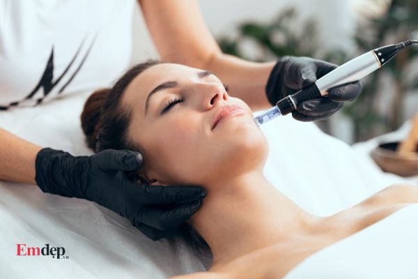 Cách trị sẹo rỗ nhẹ bằng Microneedling